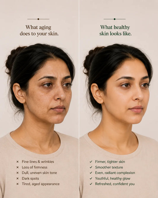 Fine Lines in Your 20s or 30s? — Beauty Tea