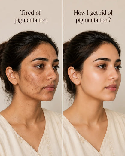 Struggling with Pigmentation? — Beauty Tea